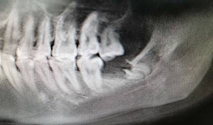 clip_image004.jpg 87c8537db175738b02504488583087b