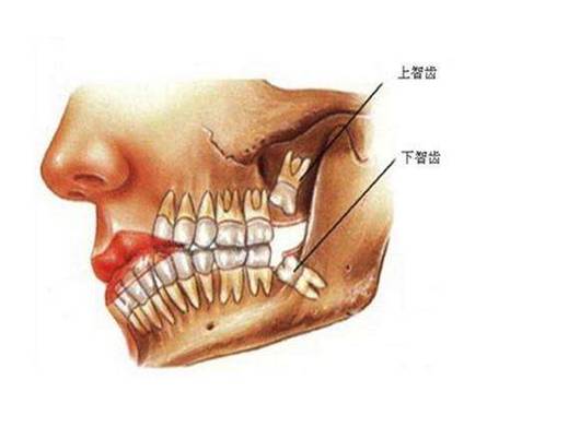 clip_image008.jpg IMG_256