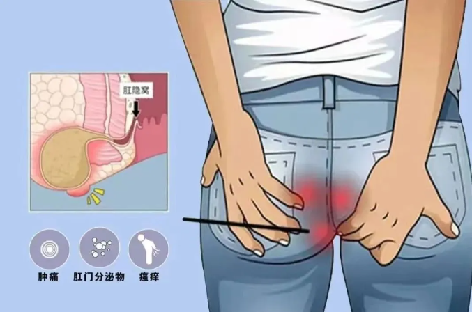 image.png image.png