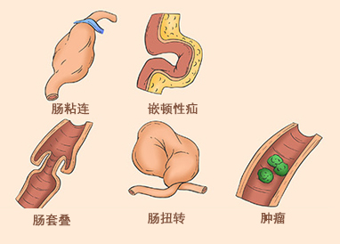 肠道疾病.jpg 肠道疾病.jpg